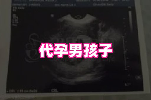 长春助孕网 4